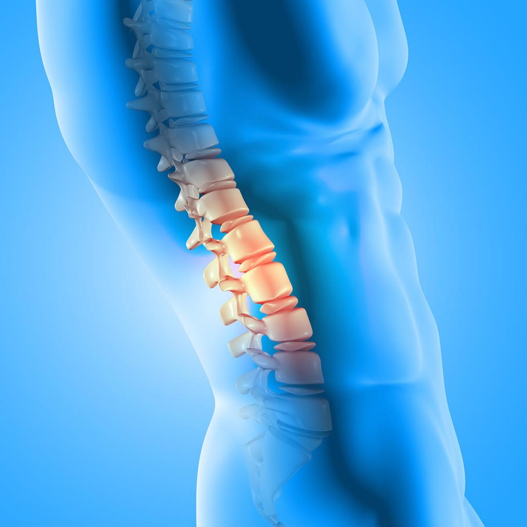 Degenerative Disc Disease Treatment In Fairfax VA SAPNA Spine And 