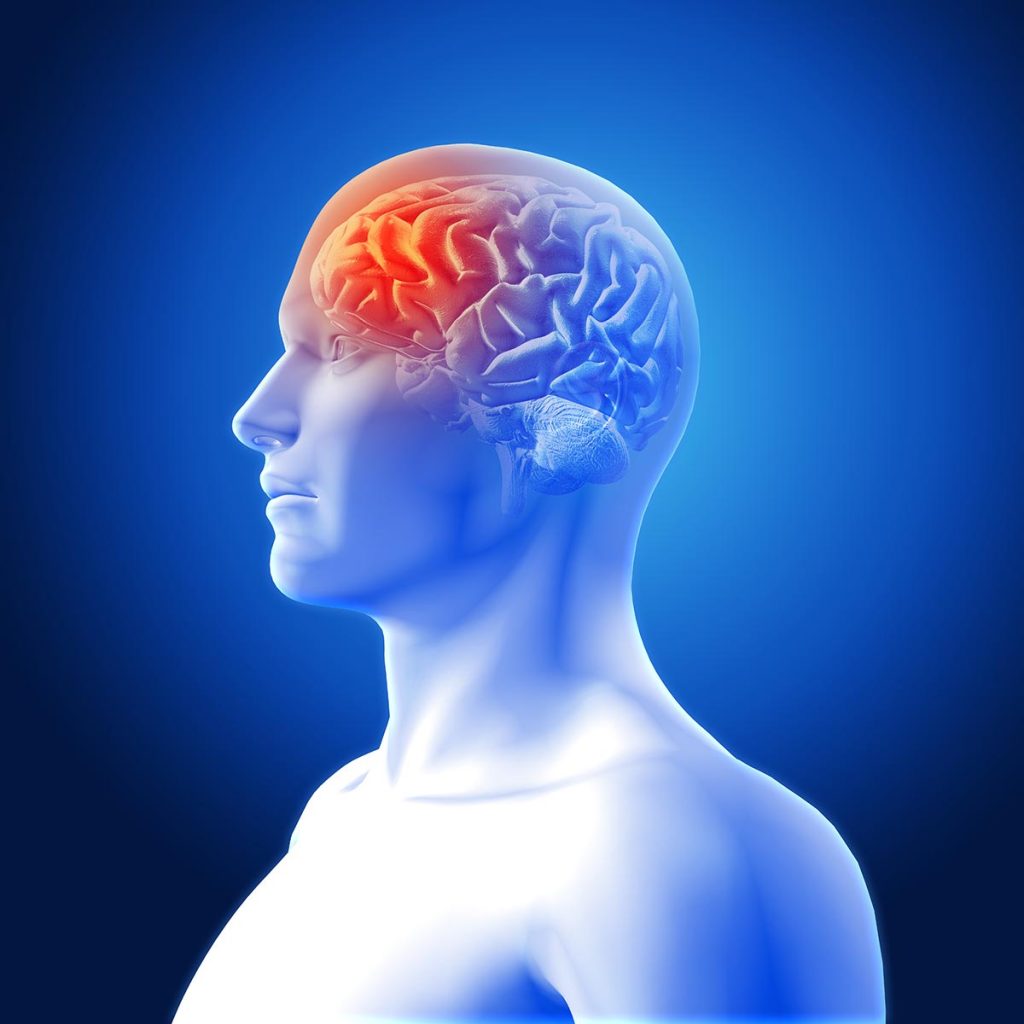 Migraine Headaches: Treatment in Fairfax, VA