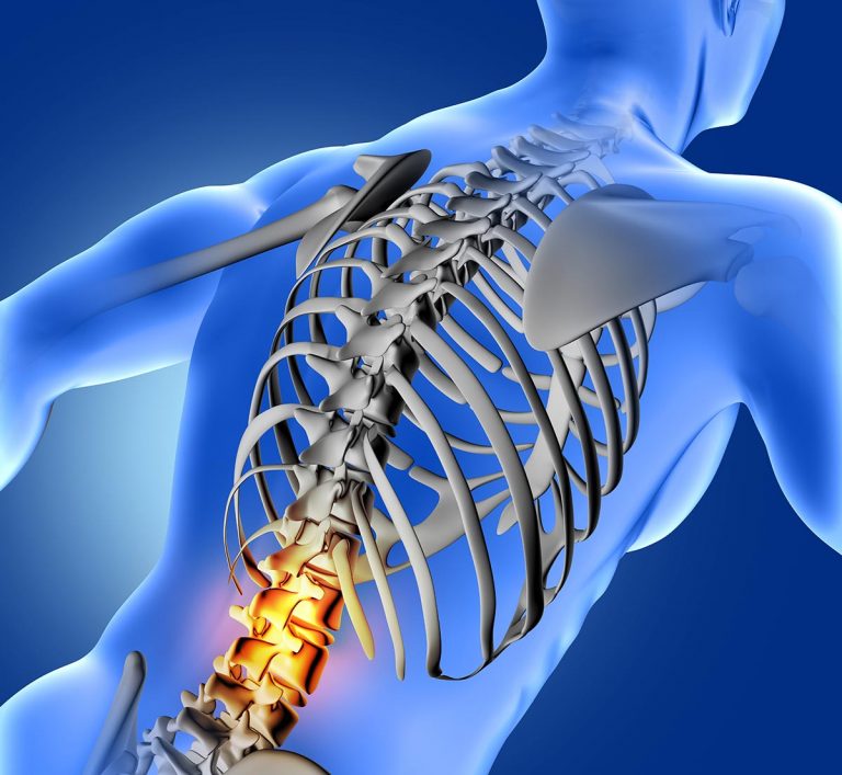 Postlaminectomy Syndrome Treatment In Fairfax VA And Potomac MD SAPNA Spine And Pain Clinic