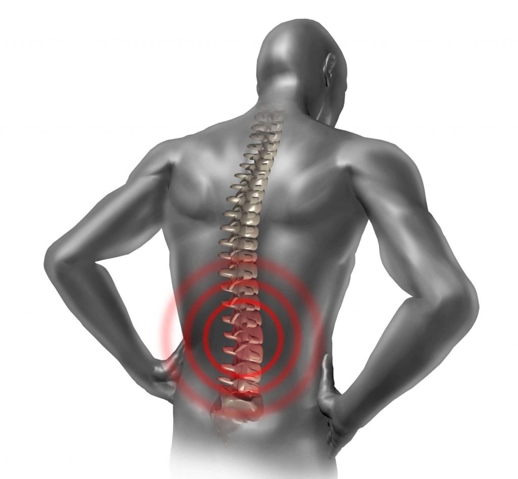 back pain arthropathy