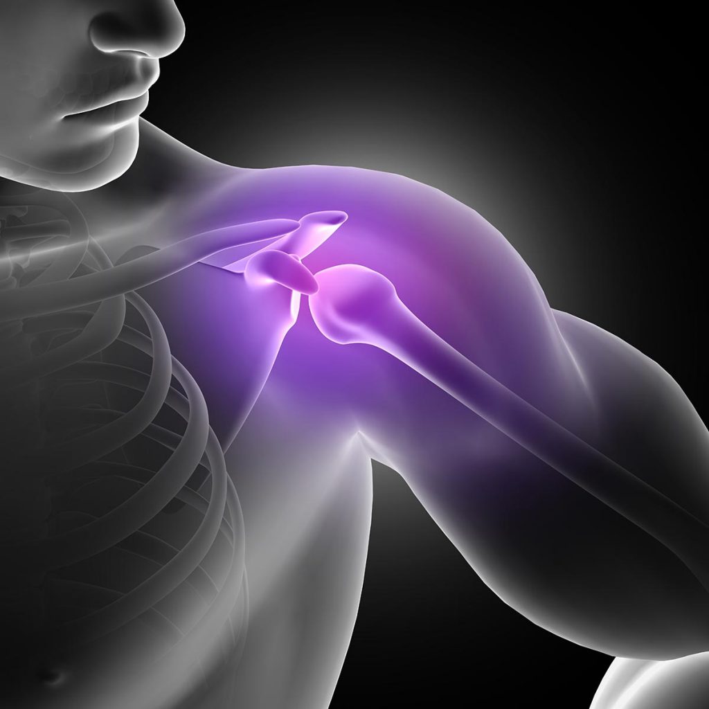 Get that (Suspected) Rotator Cuff Injury Diagnosed and Treated