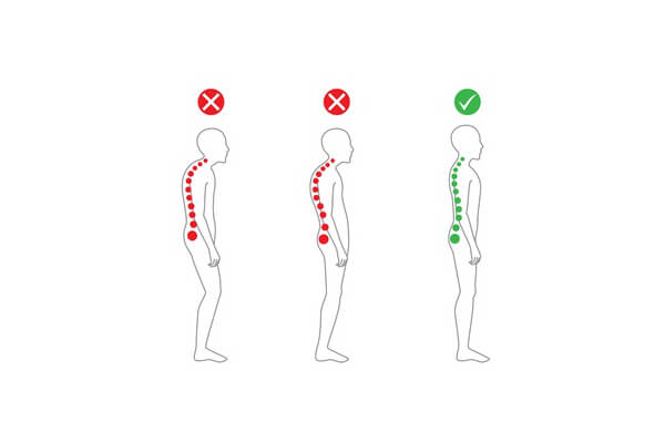 How to Straighten Your Back and Correct Spine Posture – SAPNA Pain