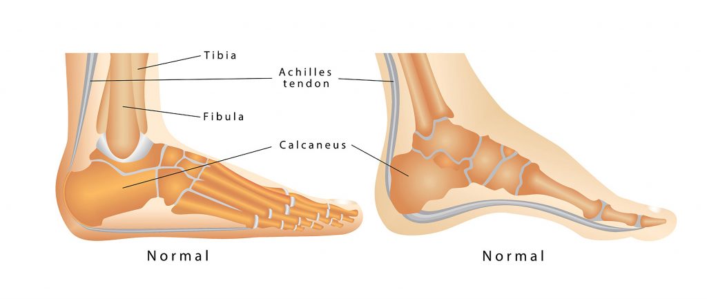Lupus Foot Pain | Foot Pain | Alliance PTP