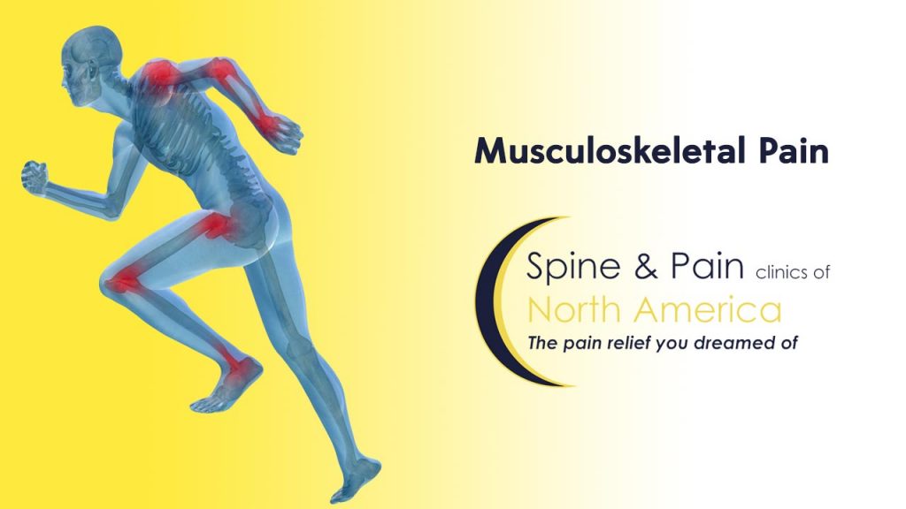 Musculoskeletal Pain Treatment In Fairfax And Dulles VA SAPNA 