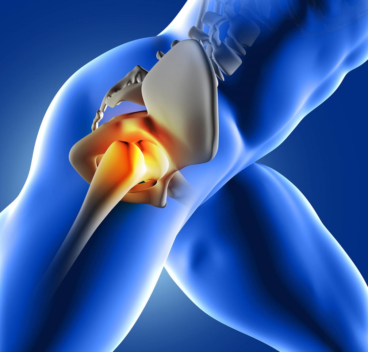 how-to-check-if-your-hip-pain-is-hip-tendonitis-sapna-pain-management